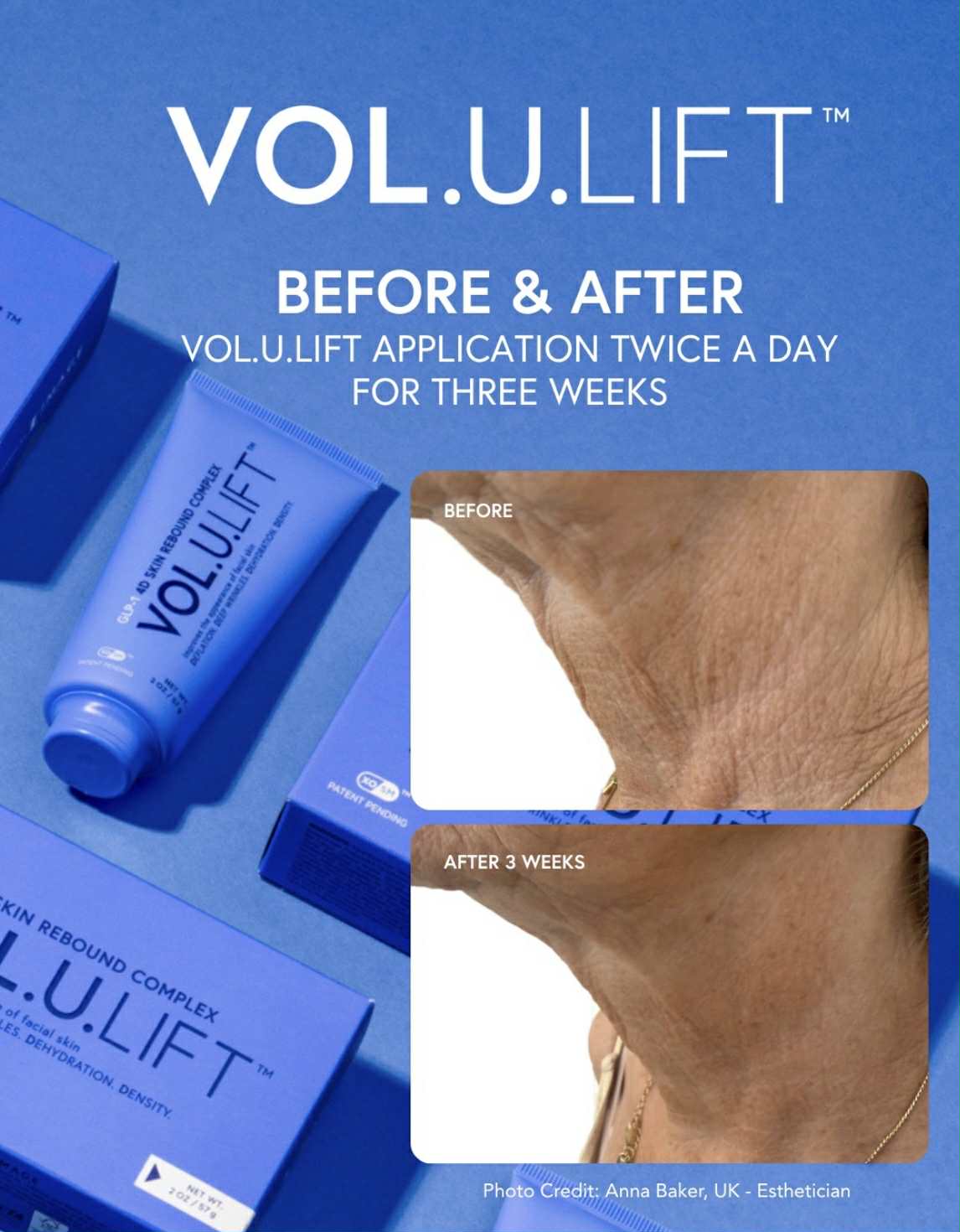 VOL.U.LIFT